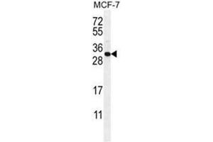 C1QL4 Antikörper  (N-Term)