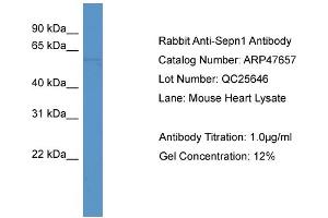 Western Blotting (WB) image for anti-Selenoprotein N, 1 (SEPN1) (C-Term) antibody (ABIN617009) (SEPN1 Antikörper  (C-Term))
