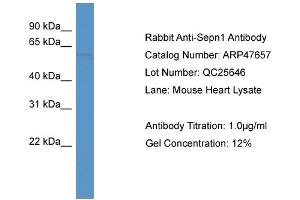 Western Blotting (WB) image for anti-Selenoprotein N, 1 (SEPN1) (C-Term) antibody (ABIN2783071) (SEPN1 Antikörper  (C-Term))