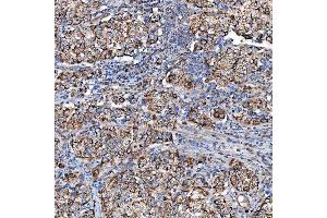 IHC analysis of SCO1 using anti-SCO1 antibody (ABIN7600609). (SCO1 Antikörper  (AA 21-301))