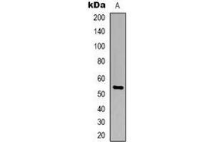Western blot analysis of TIGD3 expression in Jurkat (A) whole cell lysates.