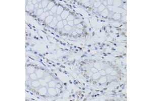 Immunohistochemistry of paraffin-embedded human colon using SNRNP70 antibody. (SNRNP70 Antikörper  (AA 150-250))