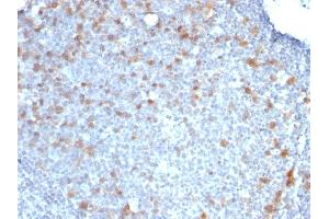 Formalin-fixed, paraffin-embedded human Tonsil stained with CDC20 Monoclonal Antibody (CDC20/1102)