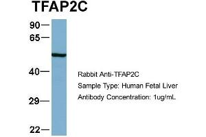 Host:  Rabbit  Target Name:  TFAP2C  Sample Type:  Human Fetal Liver  Antibody Dilution:  1. (TFAP2C Antikörper  (N-Term))