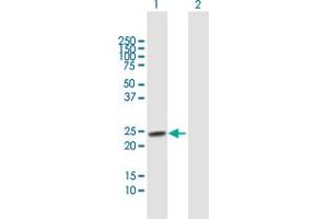 Western Blot analysis of TSPYL4 expression in transfected 293T cell line by TSPYL4 MaxPab polyclonal antibody. (TSPY-Like 4 Antikörper  (AA 1-211))