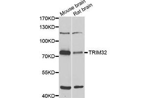 Western blot analysis of extracts of various cell lines, using TRIM32 antibody (ABIN5975475) at 1/1000 dilution. (TRIM32 Antikörper)