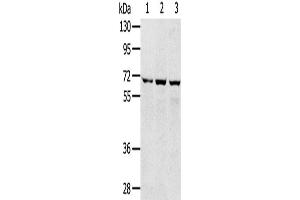 Western Blotting (WB) image for anti-Solute Carrier Family 5 (Sodium/glucose Cotransporter), Member 9 (SLC5A9) antibody (ABIN2427251) (SLC5A9 Antikörper)