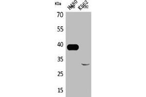 Western Blot analysis of H460 K562 cells using Cathepsin L Polyclonal Antibody (Cathepsin L Antikörper  (Internal Region))