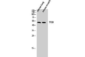 Western Blot analysis of Mouse-lung Mouse-muscle cells using TFEB Polyclonal Antibody diluted at 1:500. (TFEB Antikörper  (AA 10-90))