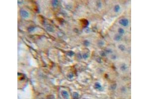 #VALUE! (Integrin alpha 1 Antikörper  (AA 125-366))