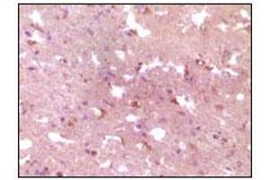 Immunohistochemical analysis of paraffin-embedded human Alzheimer brain tissue, showing cytoplasmic localization using APP mouse mAb with DAB staining. (APP Antikörper)