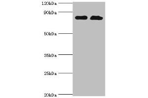 Western blot All lanes: Glutamine--tRNA ligase antibody at 2 μg/mL Lane 1: PC-3 whole cell lysate Lane 2: Hela whole cell lysate Secondary Goat polyclonal to rabbit IgG at 1/10000 dilution Predicted band size: 88, 87 kDa Observed band size: 88 kDa (QARS Antikörper  (AA 1-250))