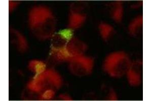 Immunofluorescence (IF) image for anti-Herpes Simplex Virus Type 1, Glycoprotein G (HSV1 gG) antibody (ABIN265554) (HSV1 gG Antikörper)