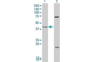 Western Blot analysis of SFRP4 expression in transfected 293T cell line by SFRP4 polyclonal antibody (A01). (SFRP4 Antikörper  (AA 211-312))