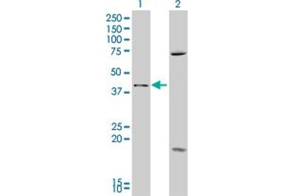 SFRP4 Antikörper  (AA 211-312)