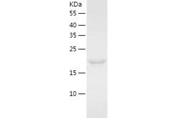 NUDT3 Protein (AA 1-172) (His tag)