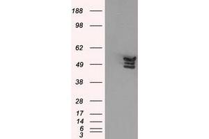 Western Blotting (WB) image for anti-Annexin A11 (ANXA11) antibody (ABIN1496647) (Annexin A11 Antikörper)