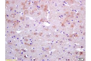 Formalin-fixed and paraffin embedded rat brain tissue labeled with RABBIT ANTI-SAHH POLYCLONAL ANTIBODY, Unconjugated (ABIN708611) at 1:200 followed by conjugation to the secondary antibody and DAB staining.