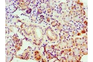Immunohistochemistry of paraffin-embedded human pancreatic tissue using ABIN7143157 at dilution of 1:100 (ASCC3 Antikörper  (AA 1-111))