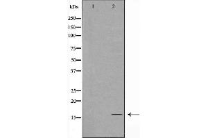 Western blot analysis of TOMM20 expression in K562 cells,The lane on the left is treated with the antigen-specific peptide. (TOMM20 Antikörper  (Internal Region))