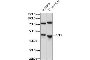 Western blot analysis of extracts of various cell lines, using SCLY antibody (ABIN7270191) at 1:1000 dilution. (SCLY Antikörper  (AA 284-453))