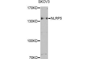 Western blot analysis of extracts of SKOV3 cells, using NLRP5 Antibody (ABIN6003618) at 1/1000 dilution. (NLRP5 Antikörper)