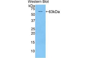 Western blot analysis of the recombinant protein. (KIR2DL2 Antikörper  (AA 22-348))
