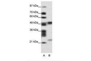 Image no. 1 for anti-PHD Finger Protein 11 (PHF11) (AA 171-220) antibody (ABIN6736092) (PHF11 Antikörper  (AA 171-220))