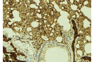 ABIN6269383 at 1/100 staining Mouse lung tissue by IHC-P. (ATRIP Antikörper  (N-Term))