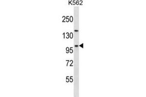 Western Blotting (WB) image for anti-Nucleolar Complex Associated 3 Homolog (NOC3L) antibody (ABIN2997653) (NOC3L Antikörper)
