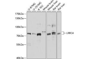 Western blot analysis of extracts of various cell lines, using LRRC4 antibody (ABIN6133394, ABIN6143343, ABIN6143344 and ABIN6214532) at 1:1000 dilution. (LRRC4 Antikörper  (AA 544-653))