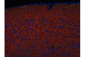 Indirect immunostaining of PFA fixed paraffin embedded mouse cortex section with anti-Homer 1/2/3 (dilution 1 : 500; red) and mouse anti-SERT (green). (Homer 1/2/3 (N-Term) Antikörper)
