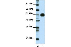 WB Suggested Anti-ZSCAN5 Antibody Titration:  0. (ZSCAN5A Antikörper  (Middle Region))