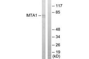 Western blot analysis of extracts from Jurkat cells, using MTA1 Antibody. (MTA1 Antikörper  (AA 171-220))
