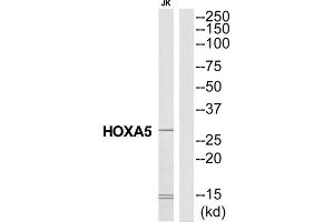 Western Blotting (WB) image for anti-Homeobox A5 (HOXA5) (N-Term) antibody (ABIN1851448) (HOXA5 Antikörper  (N-Term))