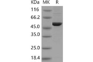 Western Blotting (WB) image for Dopa Decarboxylase (Aromatic L-Amino Acid Decarboxylase) (DDC) protein (His tag) (ABIN7320144)