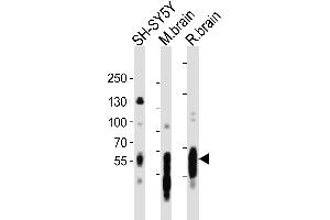 Western blot analysis of lysates from SH-SY5Y cell line, mouse brain, rat brain tissue lysate(from left to right), using PT Antibody (C-term) (ABIN6243259 and ABIN6577758). (MAPT Antikörper  (C-Term))