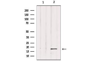 Western blot analysis of extracts from Hela, using UBD Antibody.