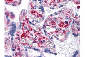 Immunohistochemical analysis of paraffin-embedded human Placenta tissues using VCAM1 mouse mAb