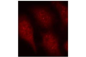 Immunofluorescence staining of methanol-fixed Hela cells using Phospho-CDK6-Y24 antibody. (CDK6 Antikörper  (pTyr24))