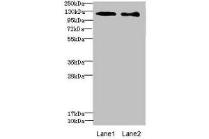 Western blot All lanes: DIAPH2 antibody at 4. (DIAPH2 Antikörper  (AA 1-120))