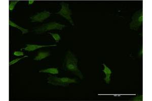 Immunofluorescence of monoclonal antibody to HHEX on HeLa cell. (HHEX Antikörper  (AA 133-237))