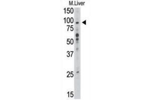 Western Blotting (WB) image for anti-Toll-Like Receptor 6 (TLR6) antibody (ABIN2998415) (TLR6 Antikörper)