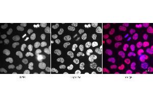 Detection of H3panAc by immunofluorescence.
