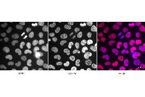 Detection of H3panAc by immunofluorescence. (Histone 3 Antikörper  (acLys))