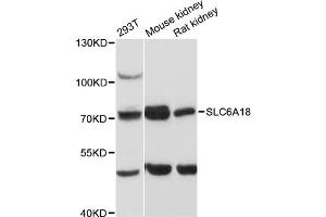 Western blot analysis of extracts of various cell lines, using SLC6A18 antibody (ABIN6290962) at 1:3000 dilution.