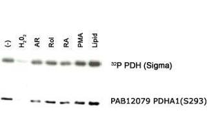 Western blot analysis of PDHA1 in an in vitro autophosphorylation of PDH complex in response to different stimulants with PDHA1 (phospho S293) polyclonal antibody . (PDHA1 Antikörper  (pSer293))