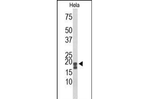 ACP1 Antikörper  (N-Term)