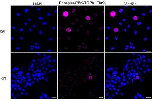 Immunocytochemical staining of HeLa cells using Phospho-PBK/TOPK (Thr9) antibody (ABIN7799752), 1:1,000), Top panel: wild-type (WT), Bottom panal: Phospho-PBK/TOPK (Thr9) shRNA knockdown (KD). (Rekombinanter PBK Antikörper  (pThr9))