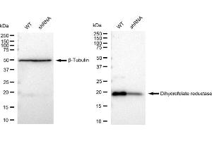 Western blotting analysis using Dihydrofolate reductase antibody (ABIN7798334). (Rekombinanter Dihydrofolate Reductase Antikörper)